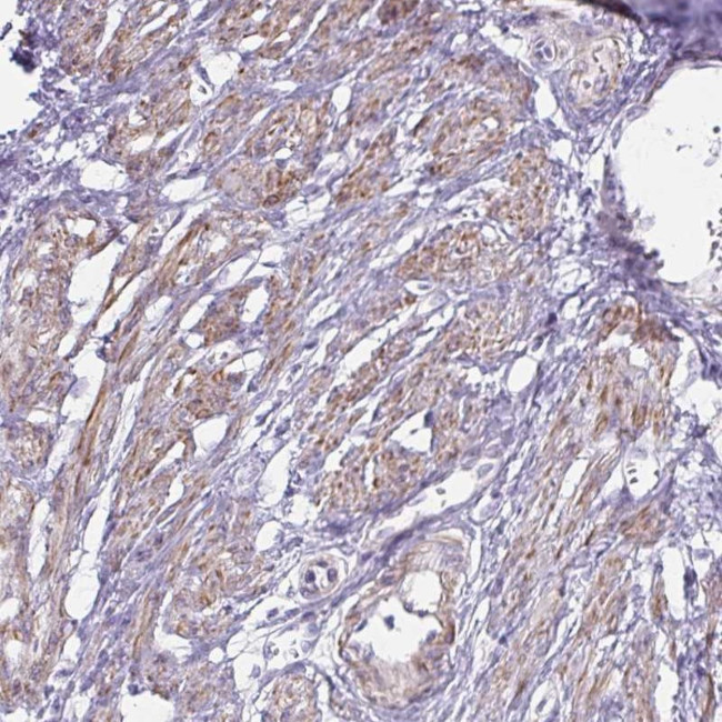 OR5P3 Antibody in Immunohistochemistry (Paraffin) (IHC (P))