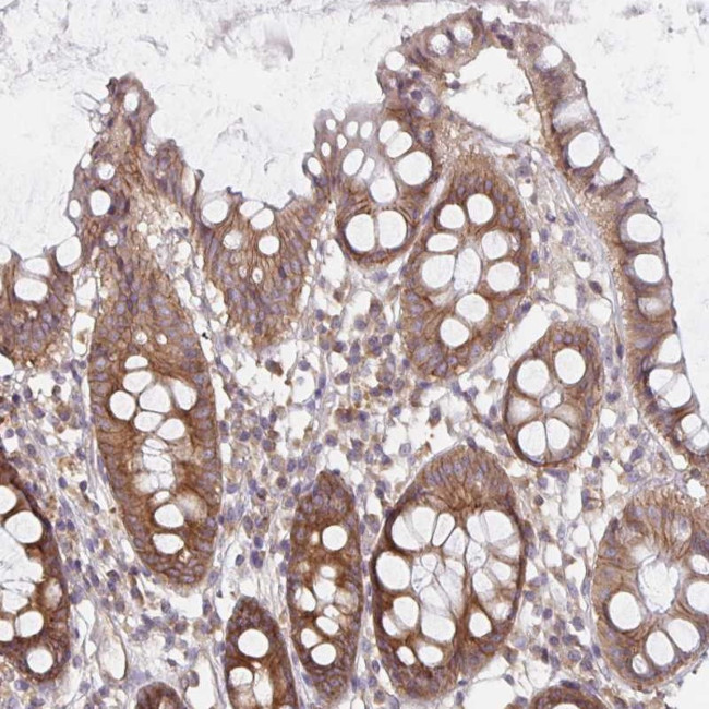 PDAP1 Antibody in Immunohistochemistry (Paraffin) (IHC (P))