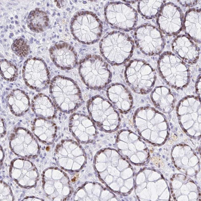 OR6T1 Antibody in Immunohistochemistry (Paraffin) (IHC (P))