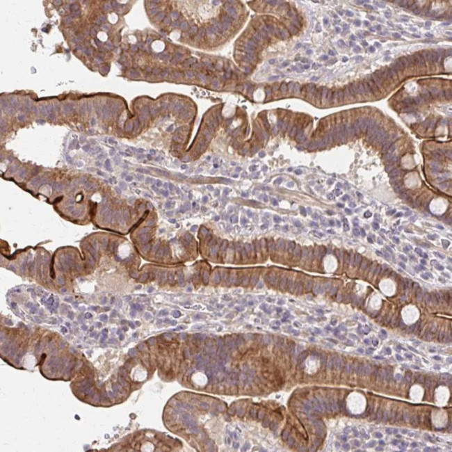 CXorf40B Antibody in Immunohistochemistry (Paraffin) (IHC (P))
