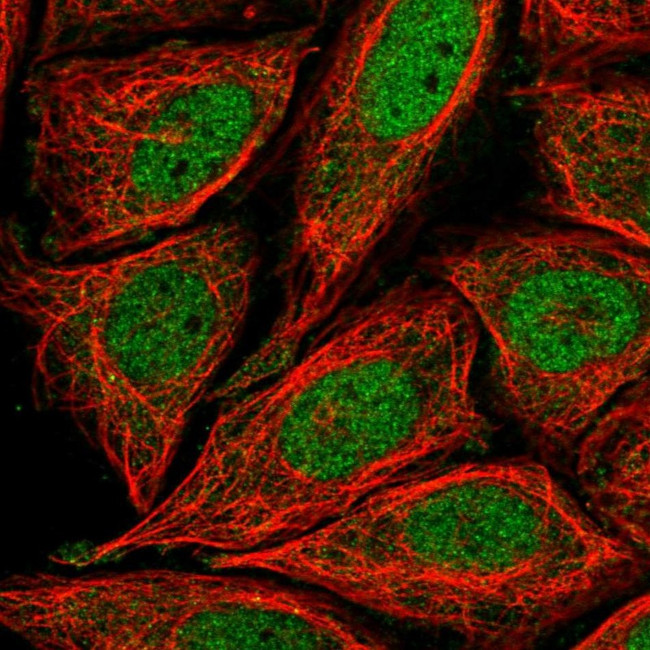 RIM4 Antibody in Immunocytochemistry (ICC/IF)