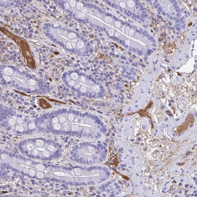 SMIM9 Antibody in Immunohistochemistry (Paraffin) (IHC (P))