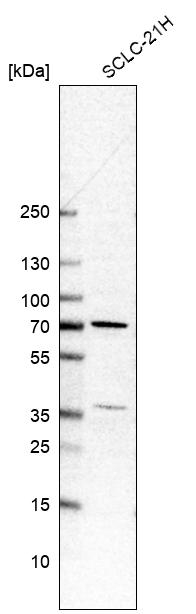 HINFP Antibody in Western Blot (WB)