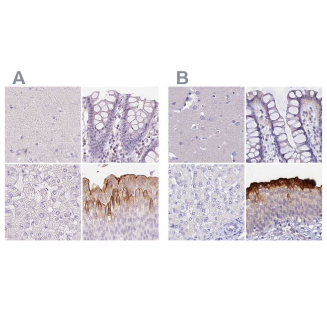 UPK2 Antibody in Immunohistochemistry (IHC)