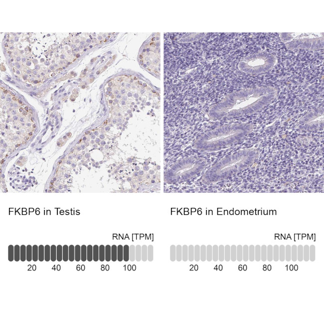 FKBP6 Antibody in Immunohistochemistry (IHC)