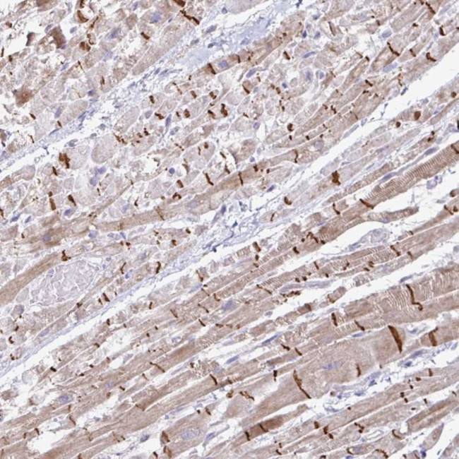 ZNF736 Antibody in Immunohistochemistry (Paraffin) (IHC (P))