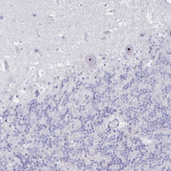 DLK2 Antibody in Immunohistochemistry (Paraffin) (IHC (P))