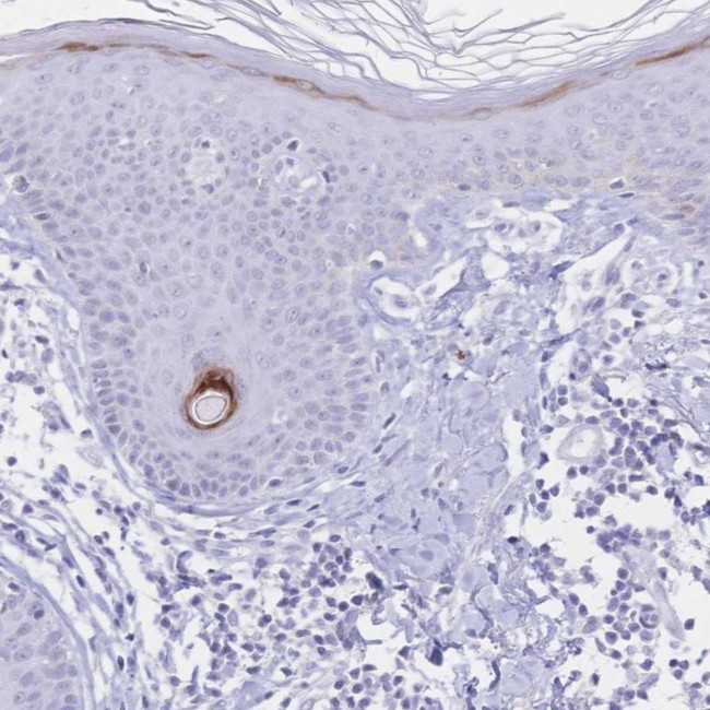 PSORS1C2 Antibody in Immunohistochemistry (Paraffin) (IHC (P))