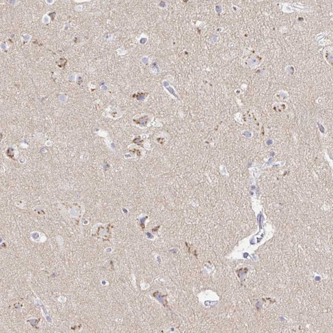 OR51D1 Antibody in Immunohistochemistry (Paraffin) (IHC (P))