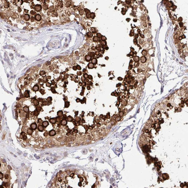 HPS1 Antibody in Immunohistochemistry (Paraffin) (IHC (P))