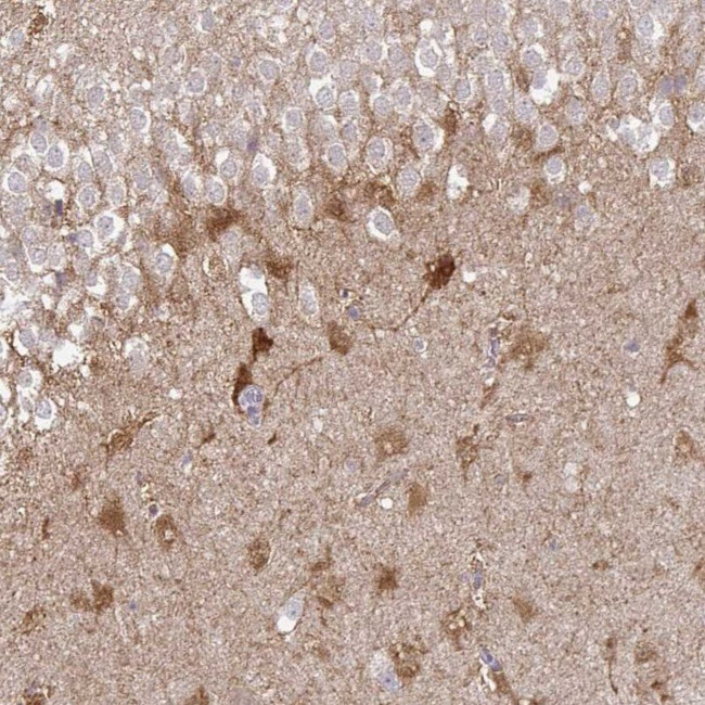 SHISA4 Antibody in Immunohistochemistry (IHC)