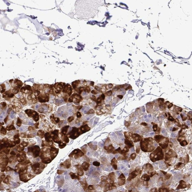 eIF5A Antibody in Immunohistochemistry (IHC)