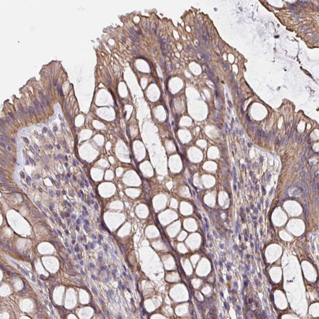 ARHGEF39 Antibody in Immunohistochemistry (Paraffin) (IHC (P))