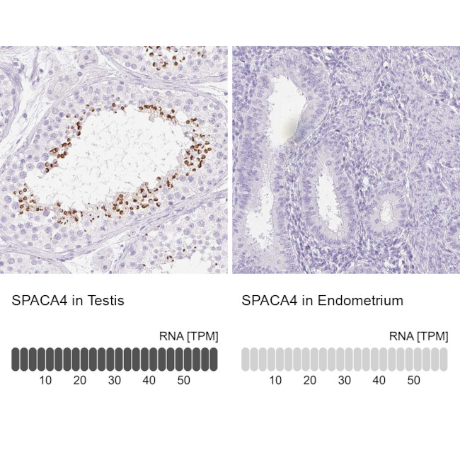 SPACA4 Antibody in Immunohistochemistry (IHC)