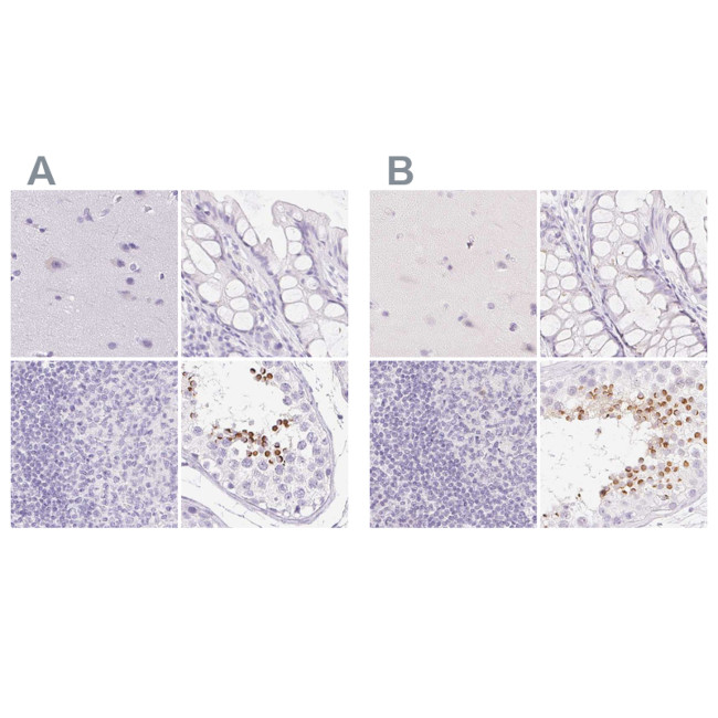 SPACA4 Antibody in Immunohistochemistry (IHC)