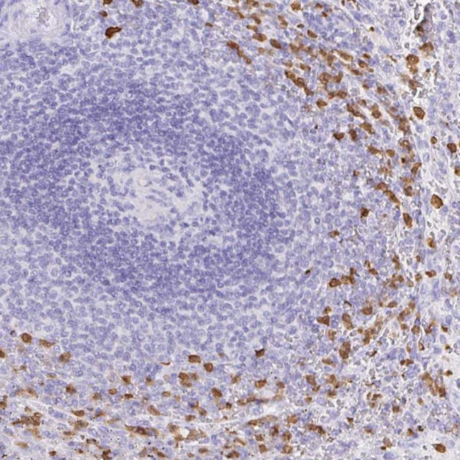 OR51A7 Antibody in Immunohistochemistry (Paraffin) (IHC (P))