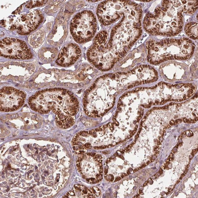 CEP95 Antibody in Immunohistochemistry (Paraffin) (IHC (P))