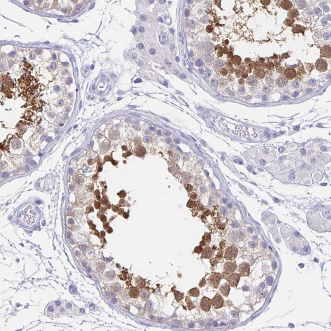 HSPA4L Antibody in Immunohistochemistry (Paraffin) (IHC (P))