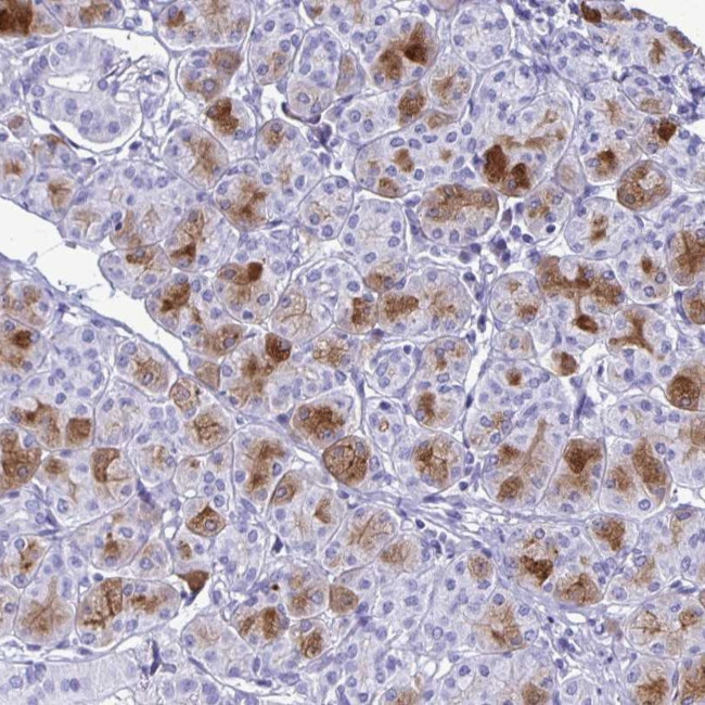 Cystatin D Antibody in Immunohistochemistry (Paraffin) (IHC (P))