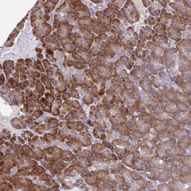 SEC62 Antibody in Immunohistochemistry (Paraffin) (IHC (P))