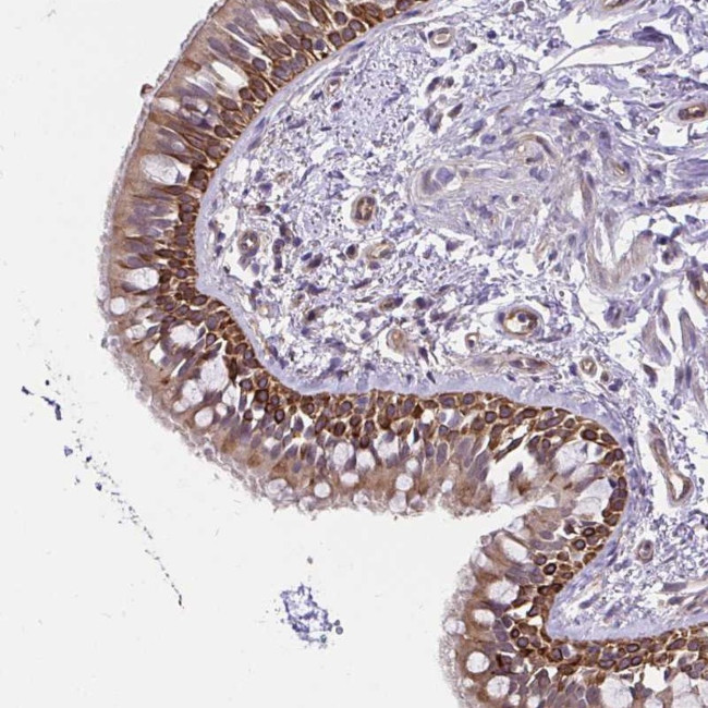CCDC122 Antibody in Immunohistochemistry (Paraffin) (IHC (P))