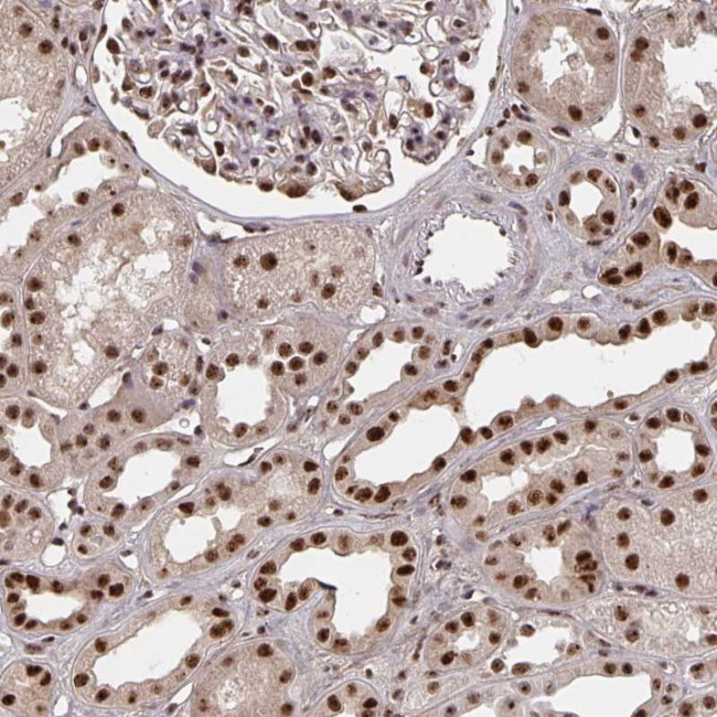LAS1L Antibody in Immunohistochemistry (Paraffin) (IHC (P))