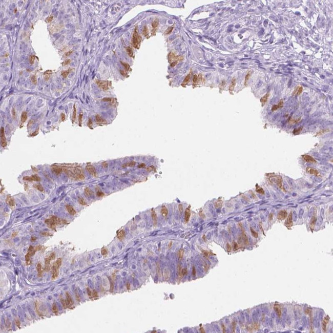 TTC29 Antibody in Immunohistochemistry (Paraffin) (IHC (P))