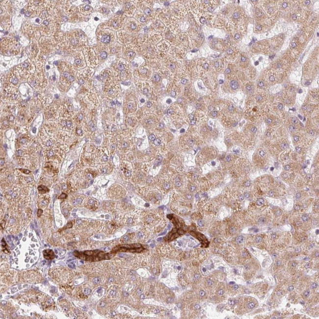 ARHGAP32 Antibody in Immunohistochemistry (Paraffin) (IHC (P))