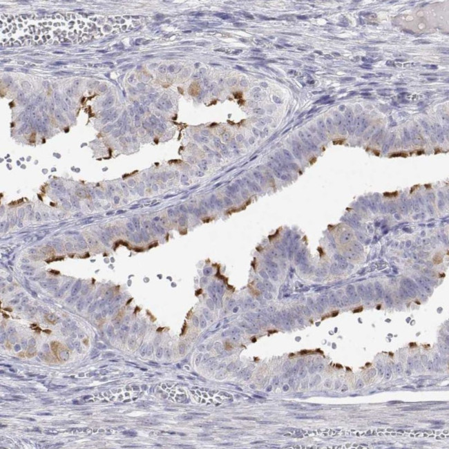 ENO4 Antibody in Immunohistochemistry (Paraffin) (IHC (P))