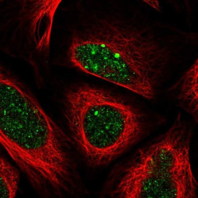 ALKBH8 Antibody in Immunocytochemistry (ICC/IF)