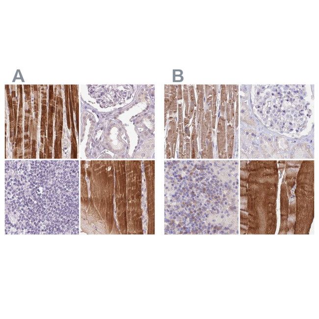 FAM168B Antibody in Immunohistochemistry (IHC)