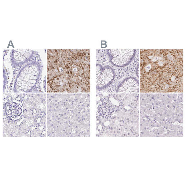 Synaptoporin Antibody in Immunohistochemistry (IHC)