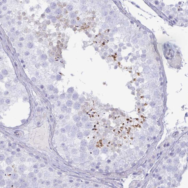 SPAG4 Antibody in Immunohistochemistry (Paraffin) (IHC (P))