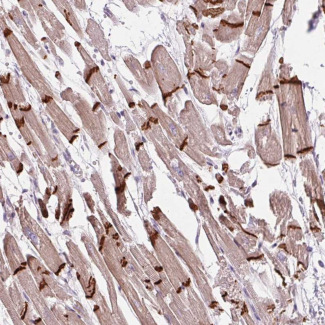 CTNNA3 Antibody in Immunohistochemistry (Paraffin) (IHC (P))