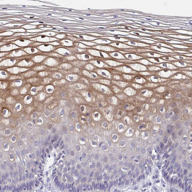 MRCK gamma Antibody in Immunohistochemistry (IHC)