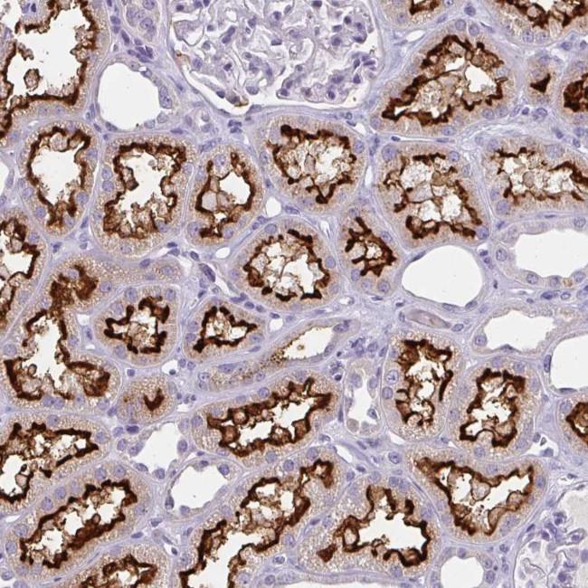 BBS12 Antibody in Immunohistochemistry (Paraffin) (IHC (P))