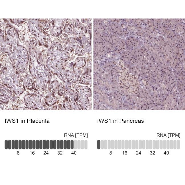 IWS1 Antibody in Immunohistochemistry (IHC)