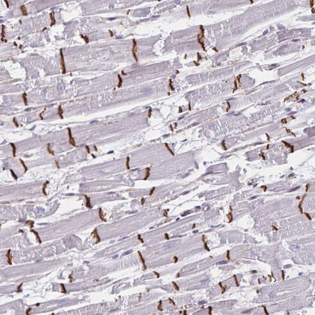 RAB9B Antibody in Immunohistochemistry (Paraffin) (IHC (P))