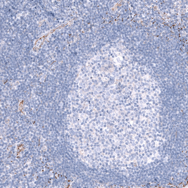 SMCO1 Antibody in Immunohistochemistry (Paraffin) (IHC (P))