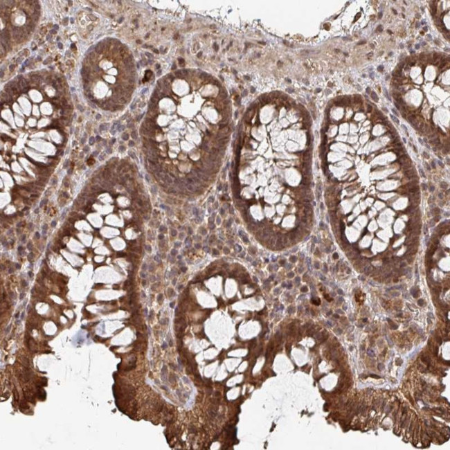 OR4C15 Antibody in Immunohistochemistry (Paraffin) (IHC (P))