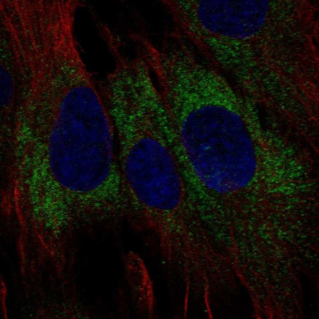 TMEM45A Antibody in Immunocytochemistry (ICC/IF)