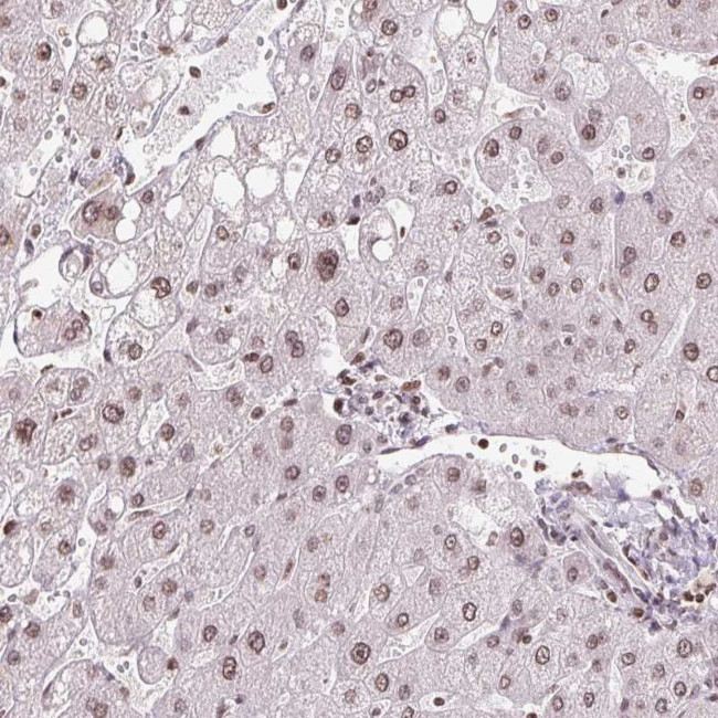 RNF181 Antibody in Immunohistochemistry (Paraffin) (IHC (P))