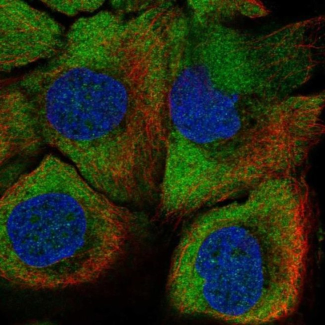 Peptidylarginine Deiminase Antibody in Immunocytochemistry (ICC/IF)