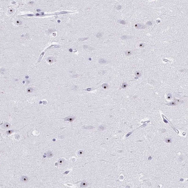 PES1 Antibody in Immunohistochemistry (Paraffin) (IHC (P))