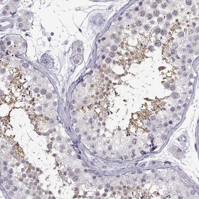 C3orf30 Antibody in Immunohistochemistry (IHC)