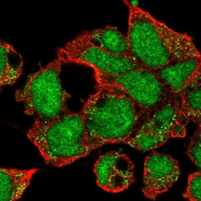 ZNF691 Antibody in Immunocytochemistry (ICC/IF)