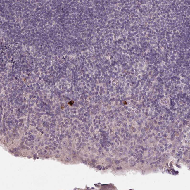 NKG2E Antibody in Immunohistochemistry (Paraffin) (IHC (P))