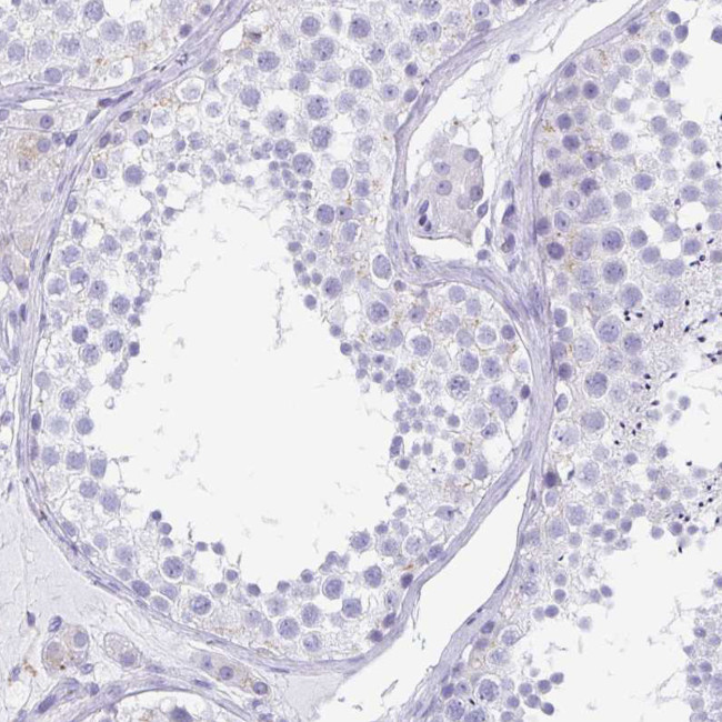 TAGLN3 Antibody in Immunohistochemistry (Paraffin) (IHC (P))