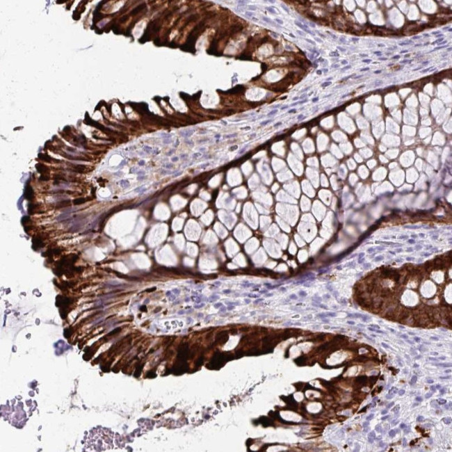 TMEM60 Antibody in Immunohistochemistry (Paraffin) (IHC (P))