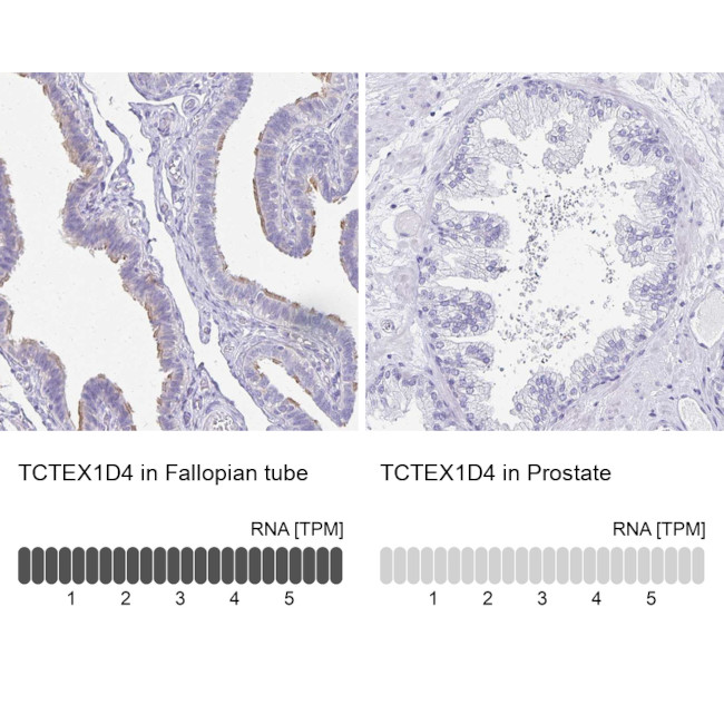 TCTEX1D4 Antibody in Immunohistochemistry (IHC)